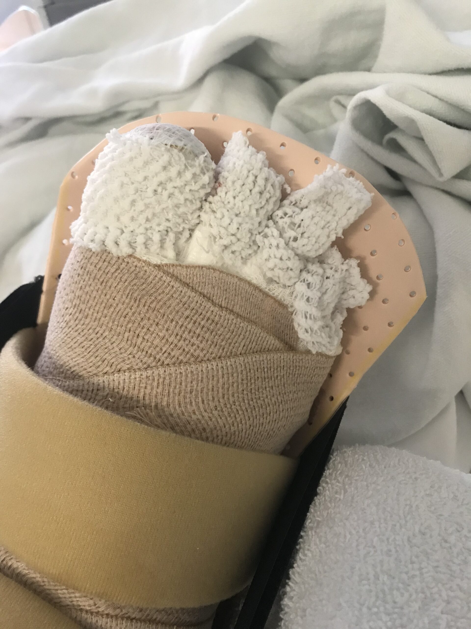 a bandaged foot